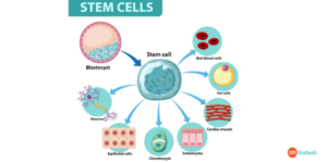 Stem cell Treatment in India 1 300x150