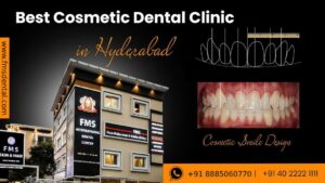 best cosmetic dental clinic in hyderabad 300x169